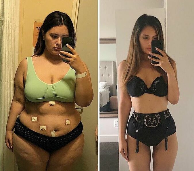 Girl before and after weight loss with capsules KETO Complete